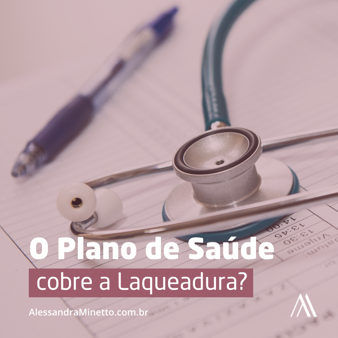 O Plano de Saúde cobre laqueadura?